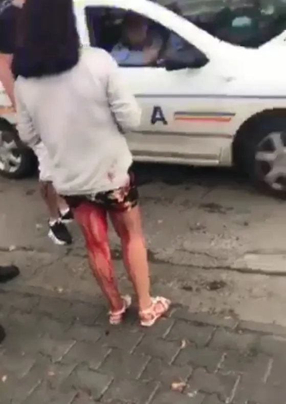 Poliţişti gălăţeni anchetaţi pentru că n-au ajutat o fată plină de sânge