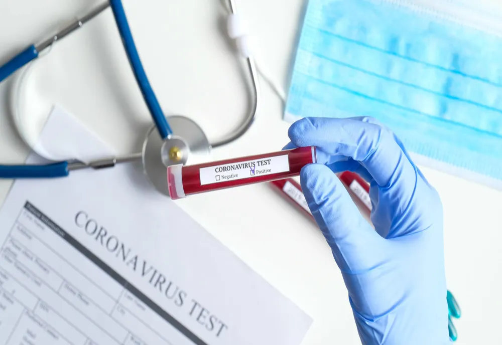 Bilanț coronavirus 24 august. Noile cifre anunțate oficial: 825 de cazuri noi, 37 de decese