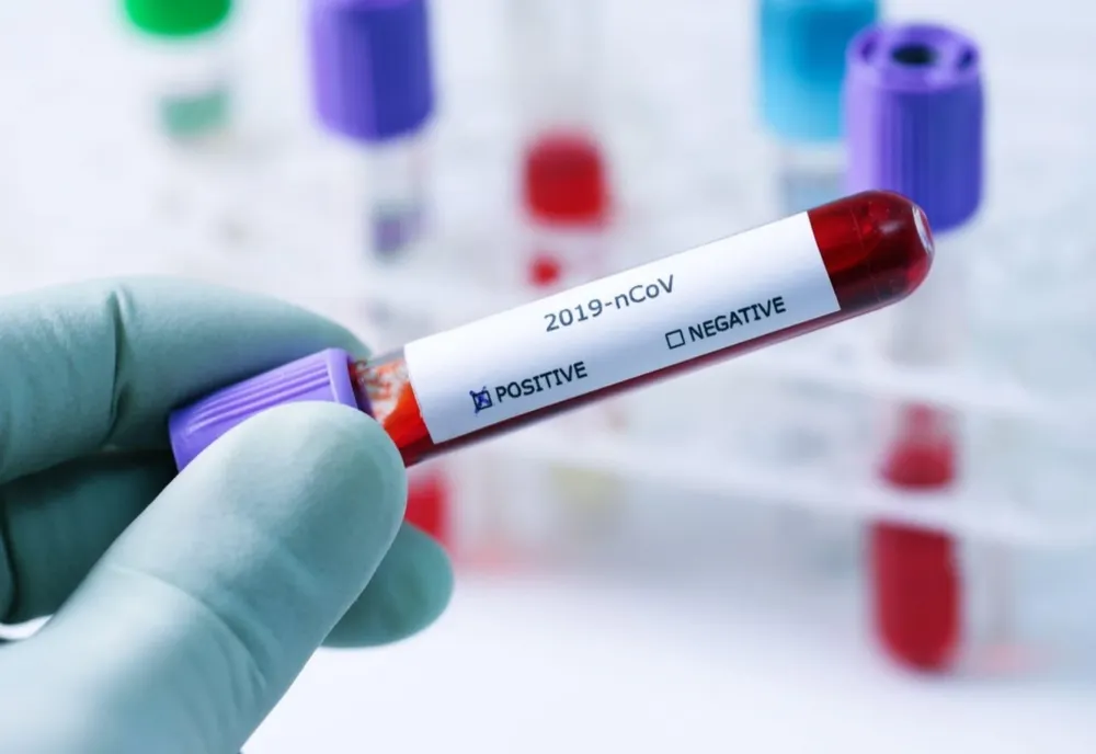 Care este situația epidemiologică în județul Galați?