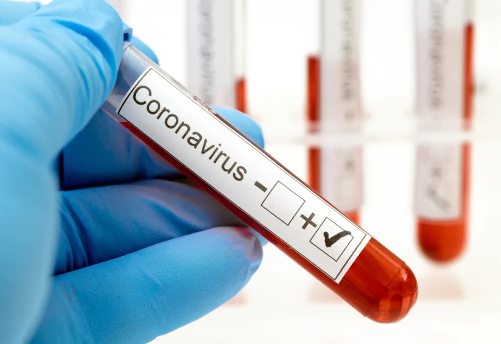 Bilanț coronavirus 17 octombrie: 11.546 cazuri noi și 299 decese