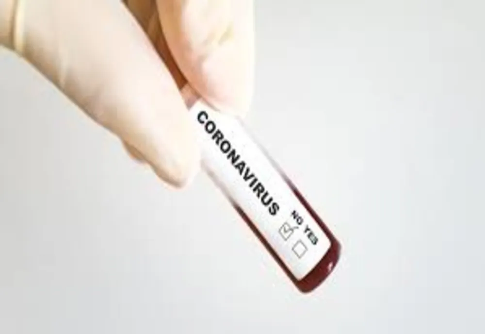 Noi măsuri adoptate pentru prevenirea răspândirii infecţiilor cu SARS-CoV-2, la nivelul județului Galați