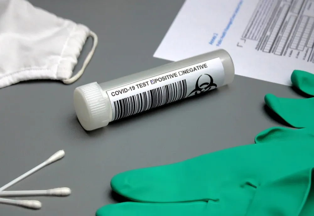 Bilanț coronavirus 21 decembrie: 826 de cazuri noi și 88 decese dintre care 22 anterioare
